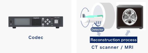 コーデック・CTスキャナー/MRI